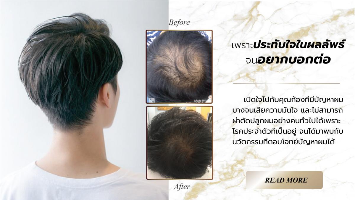 Nida Esthetic Cosmetic Surgery Bangkok