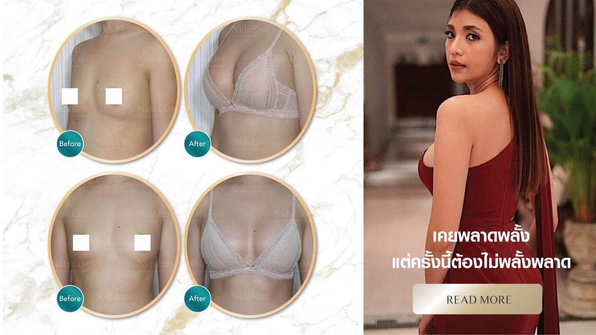 Nida Esthetic Cosmetic Surgery Bangkok