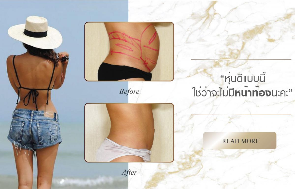 Nida Esthetic Cosmetic Surgery Bangkok