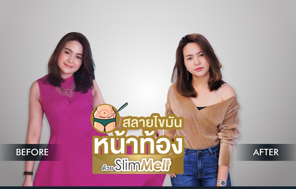 Nida Esthetic Cosmetic Surgery Bangkok