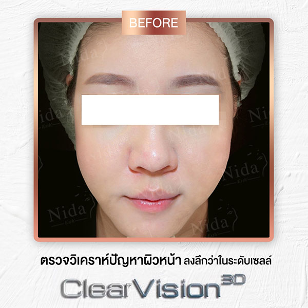 Nida Esth' ศูนยบริการทางการแพทย์ด้านความงาม แบบครบวงจร