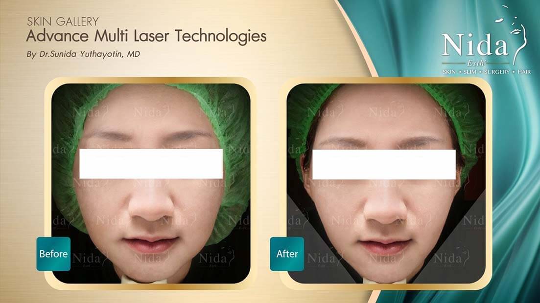 Nida Esth' ศูนยบริการทางการแพทย์ด้านความงาม แบบครบวงจร