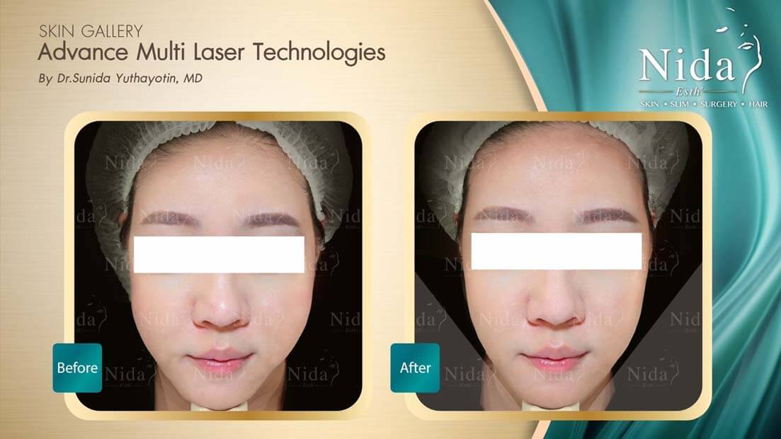 Nida Esth' ศูนยบริการทางการแพทย์ด้านความงาม แบบครบวงจร