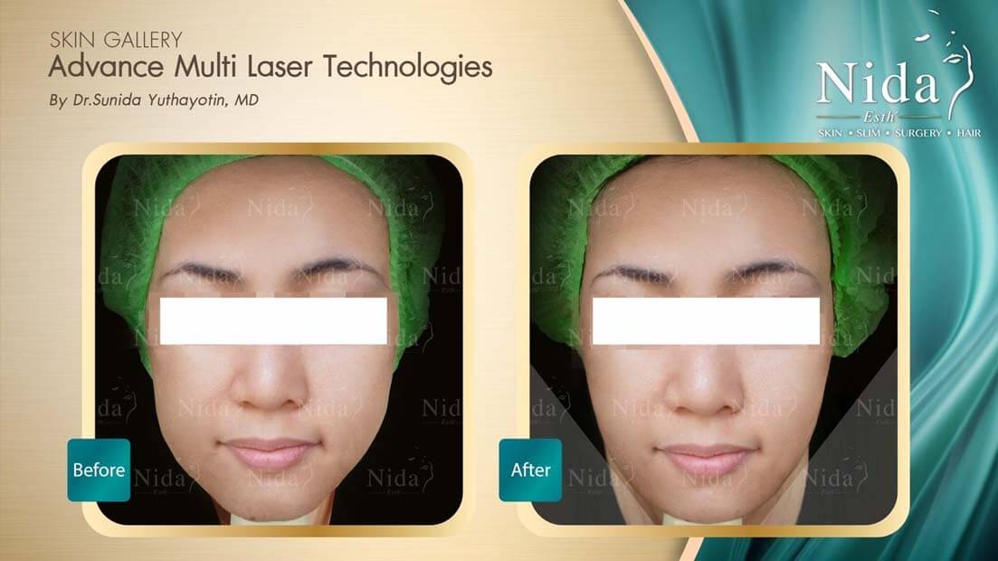 Nida Esth' ศูนยบริการทางการแพทย์ด้านความงาม แบบครบวงจร
