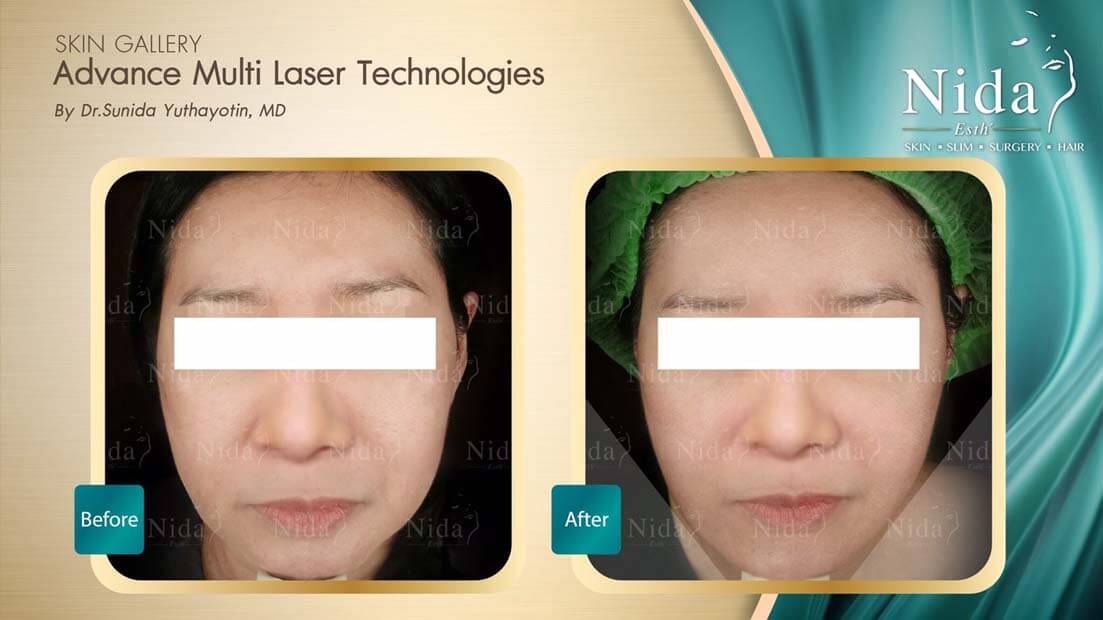 Nida Esth' ศูนยบริการทางการแพทย์ด้านความงาม แบบครบวงจร