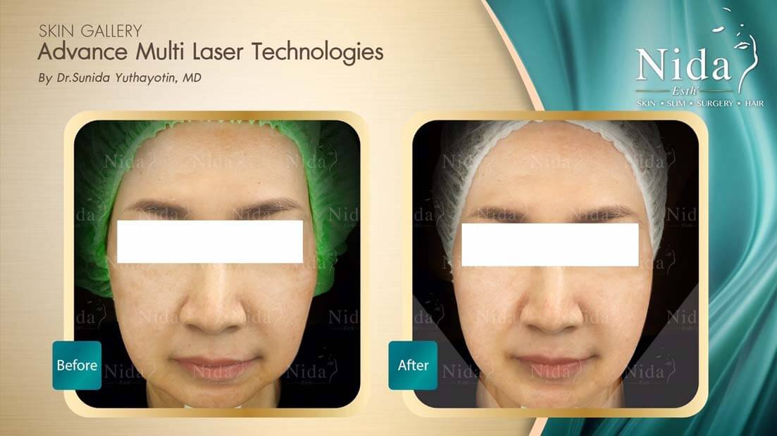 Nida Esth' ศูนยบริการทางการแพทย์ด้านความงาม แบบครบวงจร