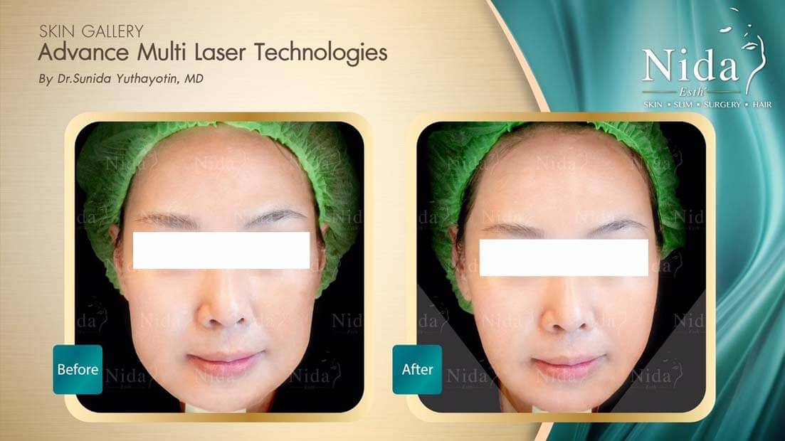 Nida Esth' ศูนยบริการทางการแพทย์ด้านความงาม แบบครบวงจร