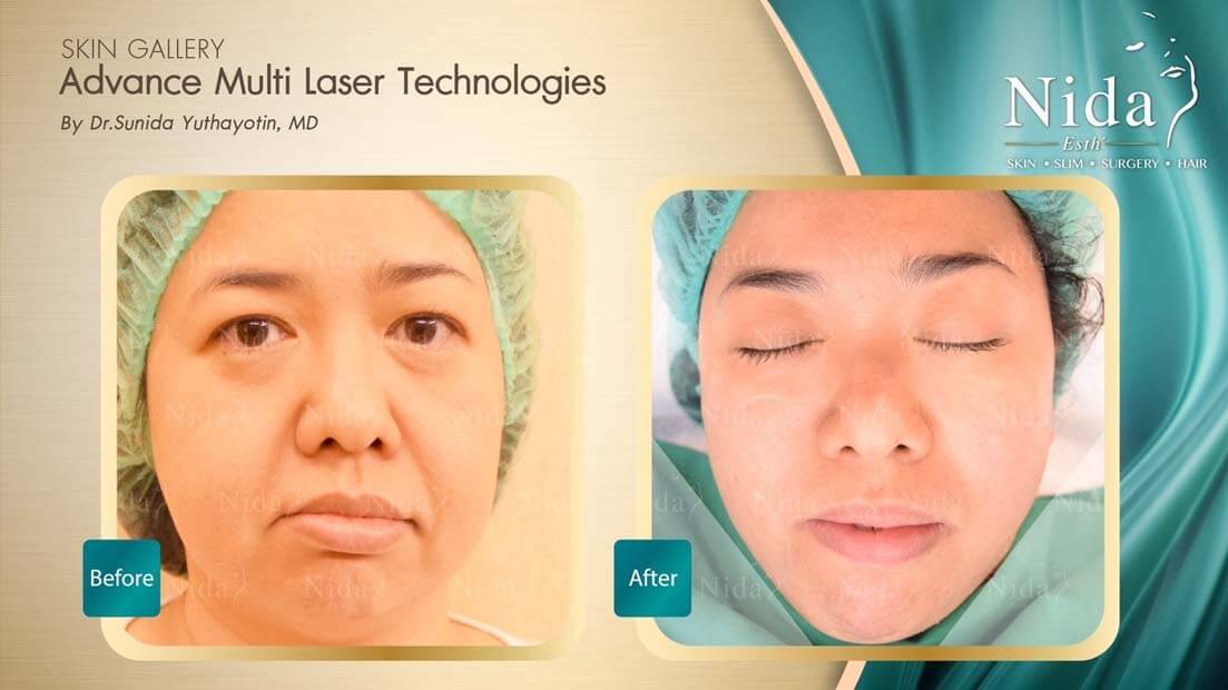 Nida Esth' ศูนยบริการทางการแพทย์ด้านความงาม แบบครบวงจร