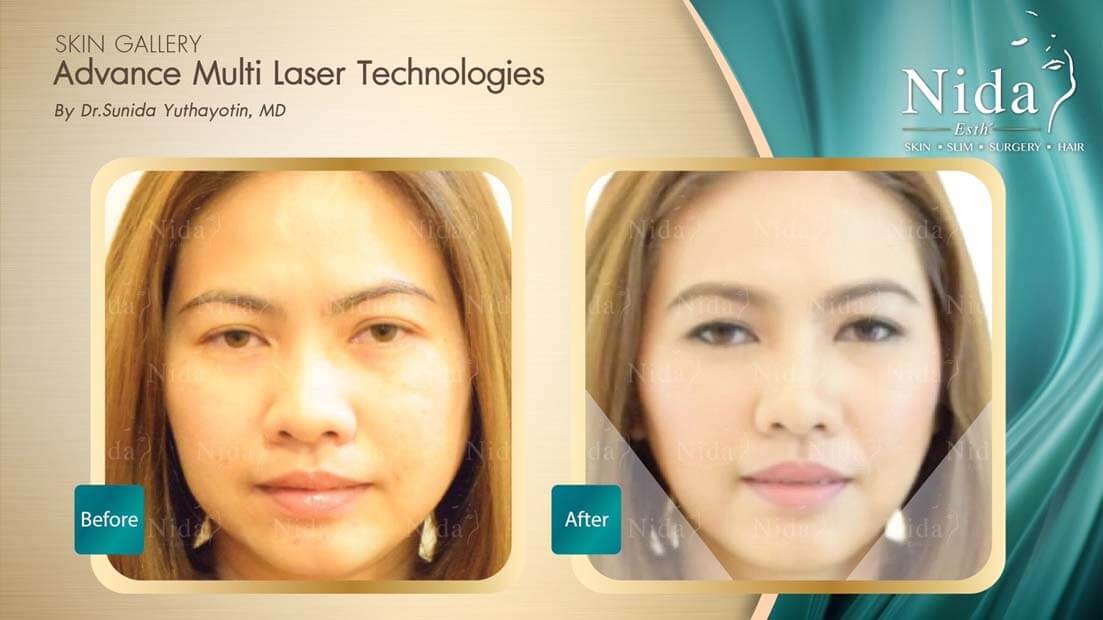 Nida Esth' ศูนยบริการทางการแพทย์ด้านความงาม แบบครบวงจร