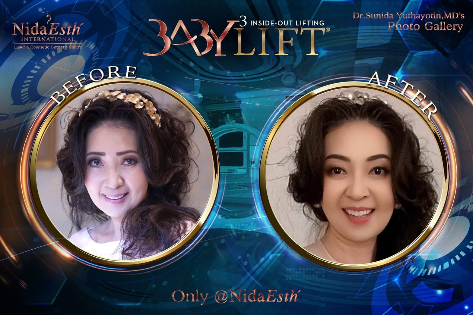Nida Esth' ศูนยบริการทางการแพทย์ด้านความงาม แบบครบวงจร