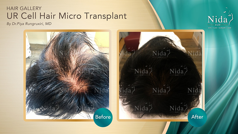 Nida Esthetic Cosmetic Surgery Bangkok