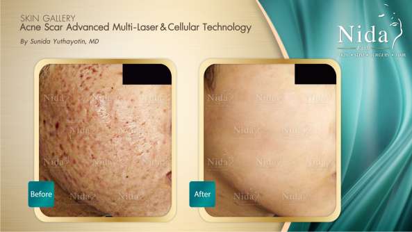 Nida Esthetic Cosmetic Surgery Bangkok