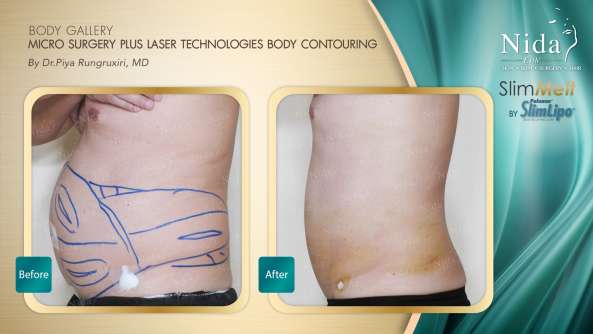 Nida Esthetic Cosmetic Surgery Bangkok