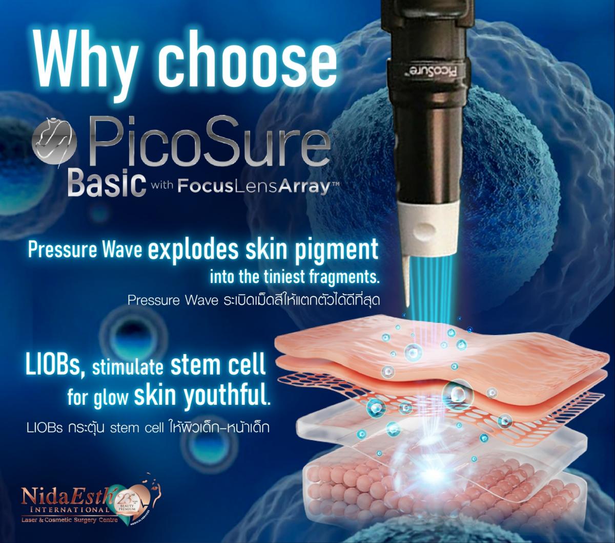 Advantage of PicoSure