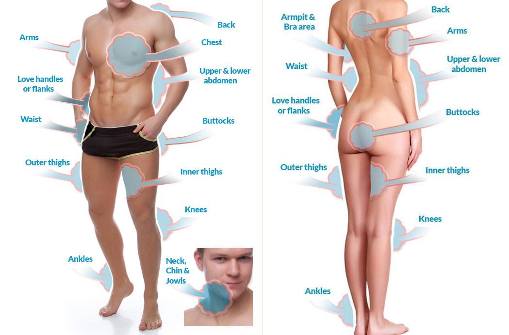 Slim Melt Area